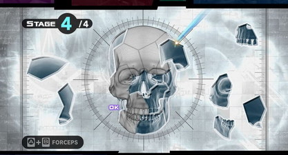 Trauma Team