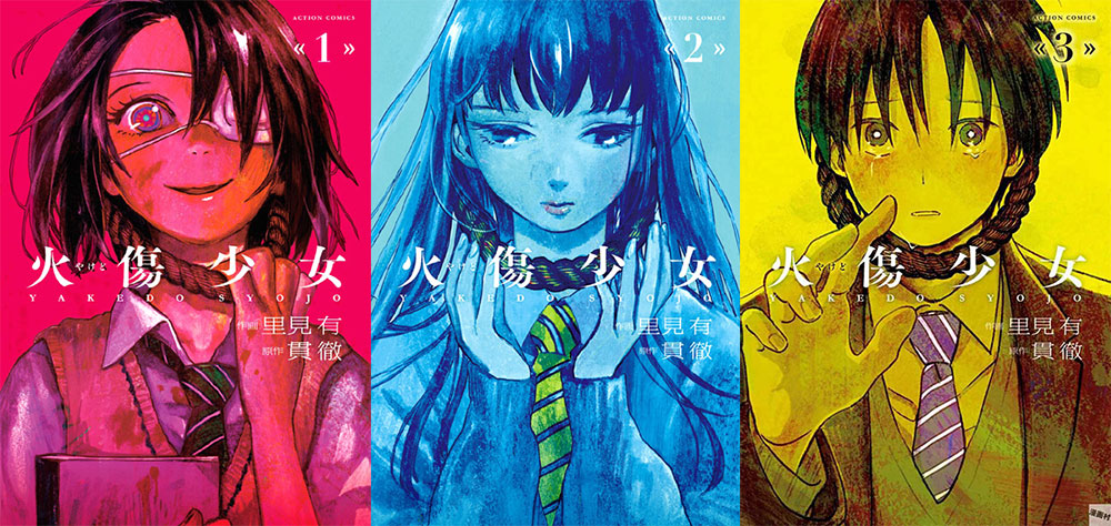 Yakedo shojo Yakedo shojo